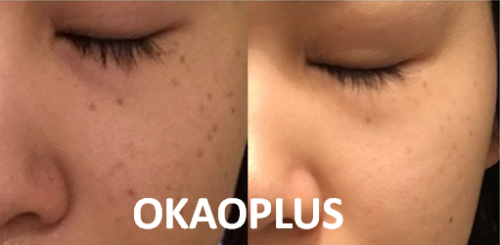 顔色が悪い それ 肌の くすみ が原因かも 正しい肌のくすみケアとは Okaoplus