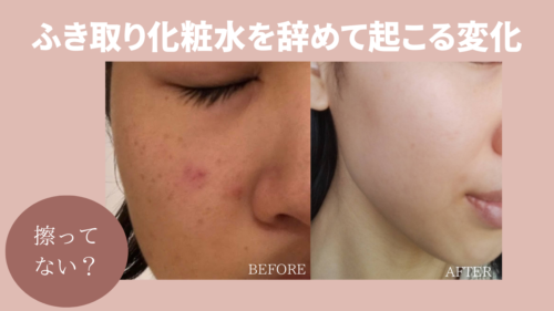 拭き取り化粧水のイメージ